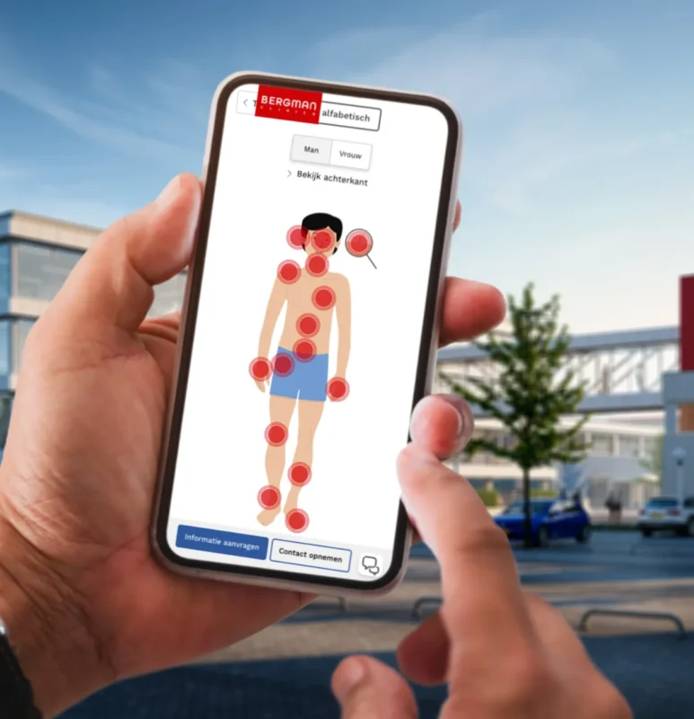Het op mobiel gebruiksvriendelijke anatomisch beeld met links naar informatie over behandelingen van Bergman Clinics
